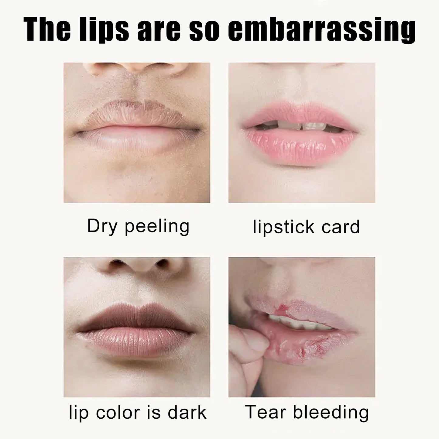 EELHOE Cherry Crystal Lip Mask Hydrates And Moisturizes Lips, Removes Dead Skin Without Greasy And Reduces Lip Lines