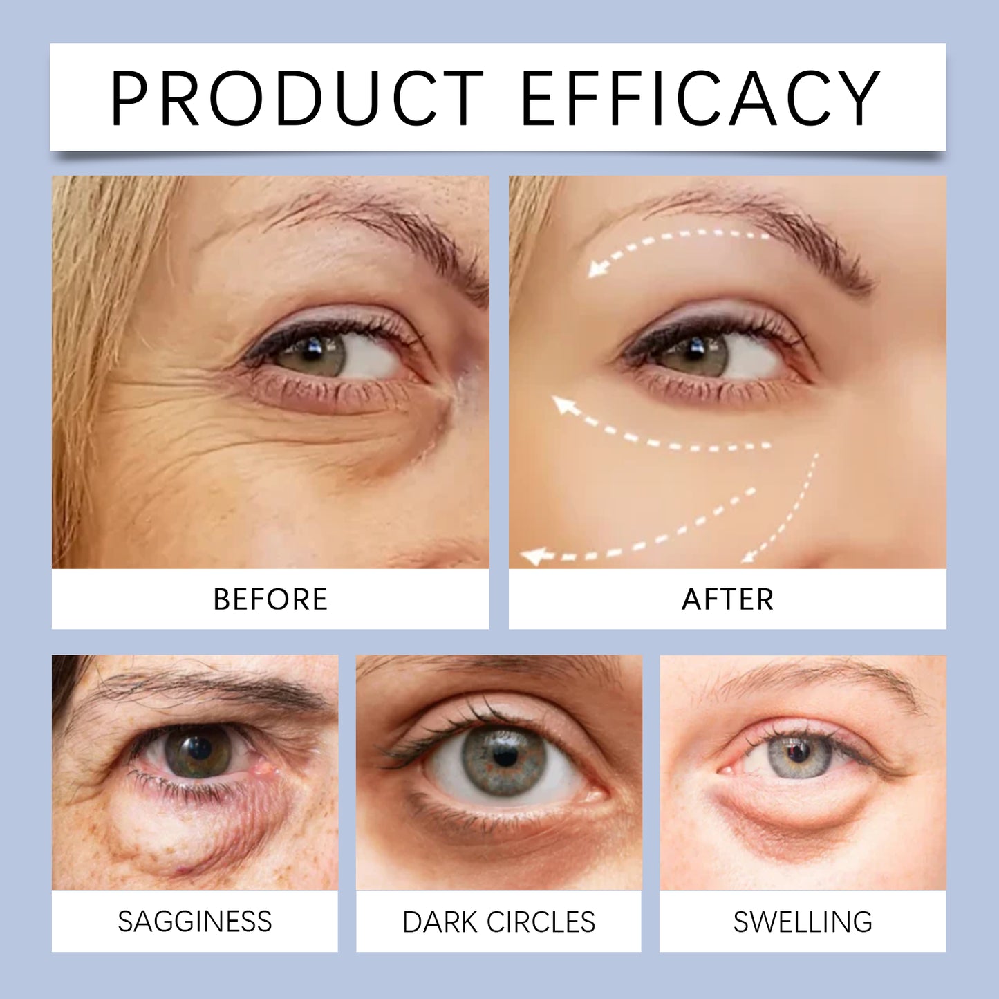 EOHOE Electric Eye Cream Gently Moisturizes And Cares For The Eyes, Nourishing And Softening The Skin Around The Eyes. Daily Care Eye Cream